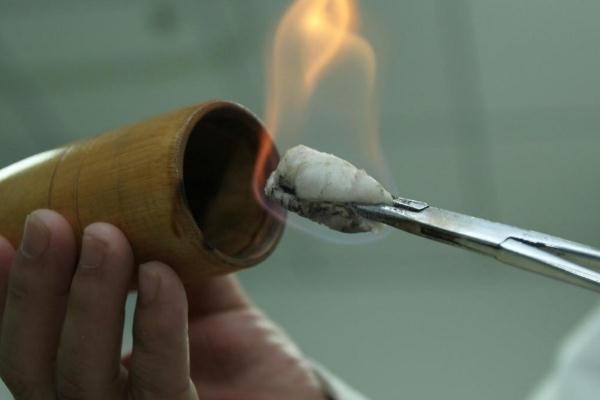 拔火罐的印子多久消除 拔火罐的频率多久一次 拔火罐的印子多久消除 拔火罐的频率多久一次