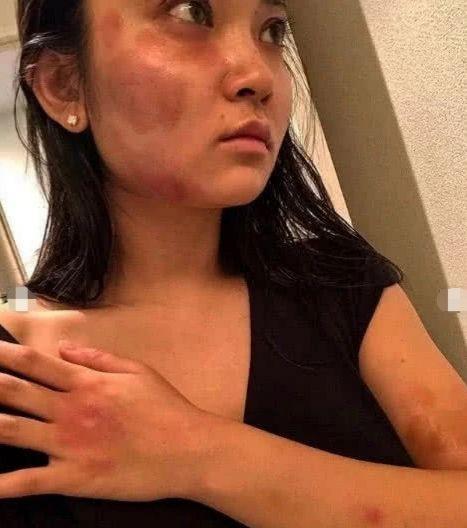 歌手郝云老婆曝被家暴和出轨,娱乐圈家暴再起风云,为何家暴不断