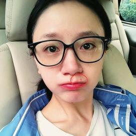 她被称为女版翟天临,却因去掉一颗痣人气大减,今出席综艺无人识