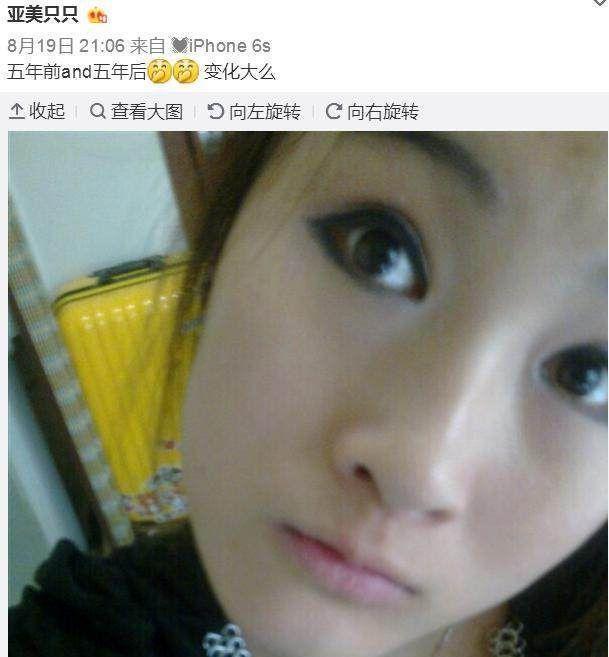 亚美只只晒五年前原装脸，网友：换了一种丑法
