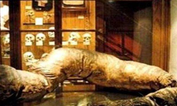 史上第一个被“屎”憋死的人，三年没上厕所