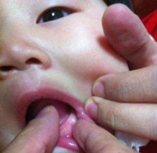 ​宝宝长牙的注意事项和宝宝牙龈变化