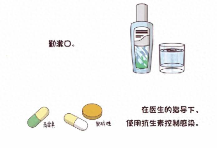 口腔常识手册之智齿,一组图带你了解智齿为什么疼