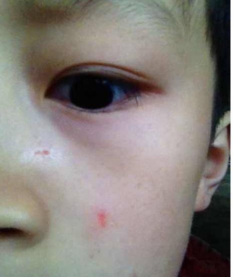 小童星崔璨生活近照：6岁挑战400多场戏，11岁一年演4部电视剧