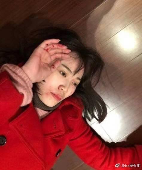 马蓉被打照片全是摆拍,网友:摊上马蓉,王宝强这辈子都不好过!