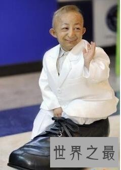 中国最矮的人何平平,一生仅74.6厘米(21岁离世)