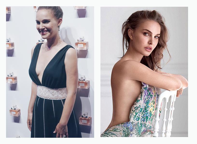 怎么瘦手臂上的拜拜肉 每天9动作还你小胳膊