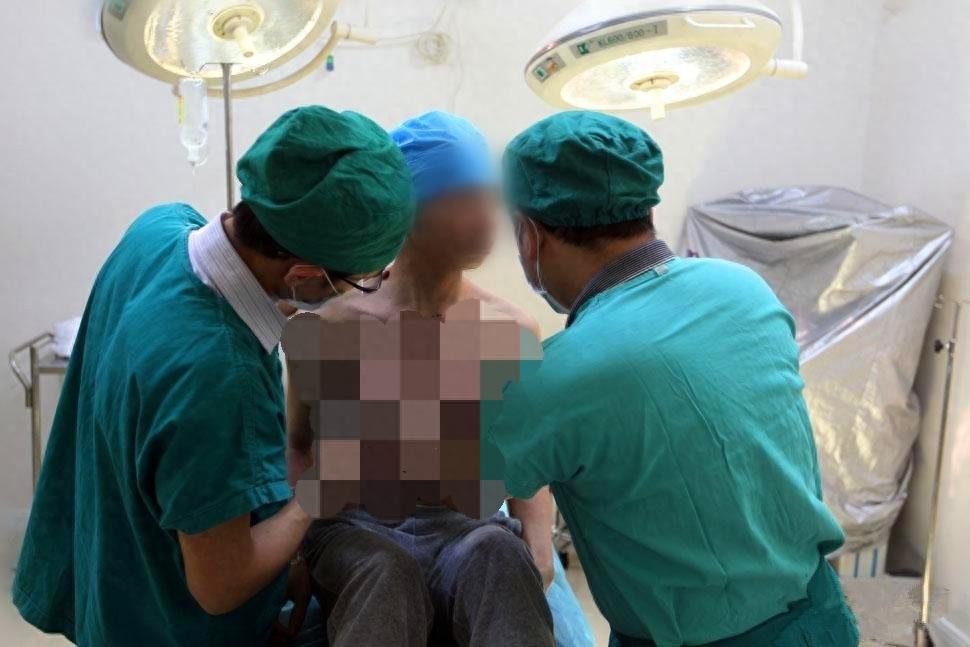 揭秘泰国变性手术全过程:为了嫁给心爱的男人