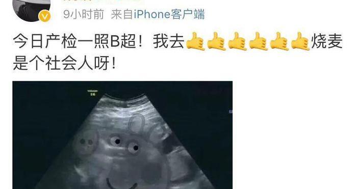 闫云达宣布退出德云社之后,只有这个徒弟公开力挺了郭德纲?