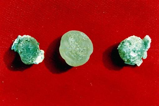 从科学角度讲,舍利子是什么物质