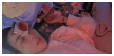 ​33岁知名女星云南发生车祸，伤情严重被缝54针，网友：好揪心