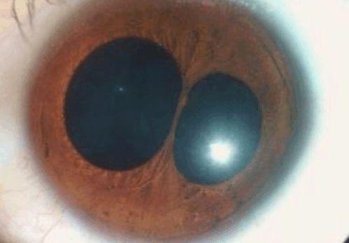 “重瞳”真是帝王征兆? 看看历史上这些重瞳之人下场