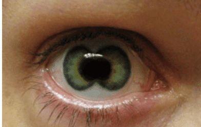 “重瞳”真是帝王征兆? 看看历史上这些重瞳之人下场