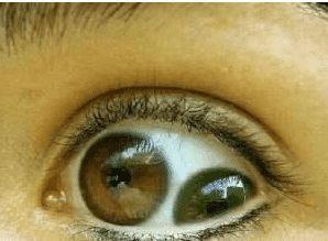 “重瞳”真是帝王征兆? 看看历史上这些重瞳之人下场