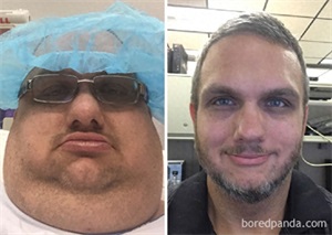 减肥前后对比照,减肥后判若两人,自己都认不出自己了!