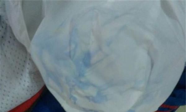 怎样去除衣服上的染色污渍